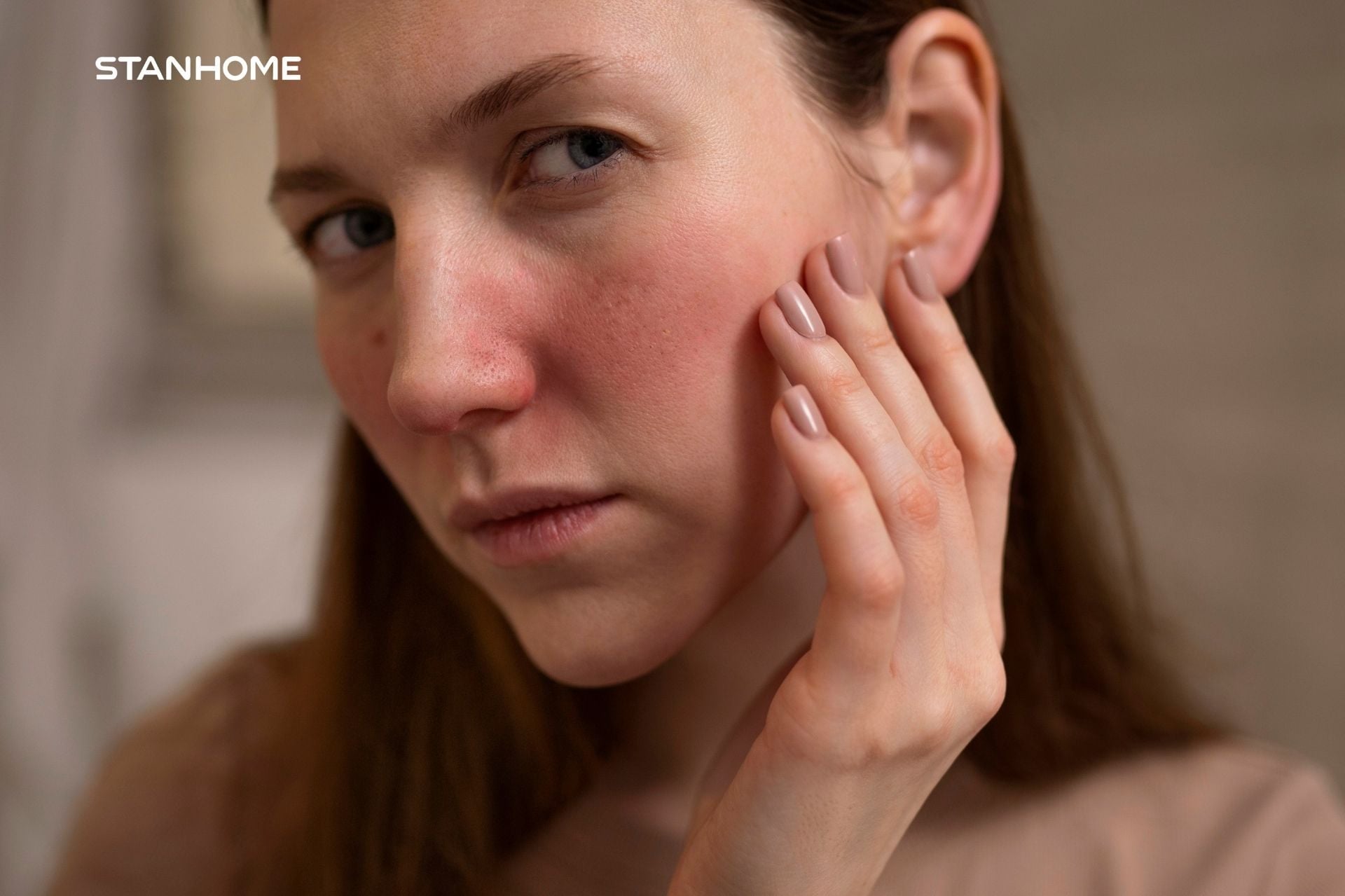 tình trạng da khô bong tróc có thể tăng nặng hơn với bệnh lý viêm da cơ địa, vảy nến