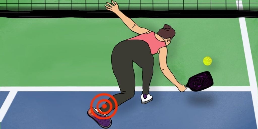 Chấn thương thường gặp khi chơi Pickleball