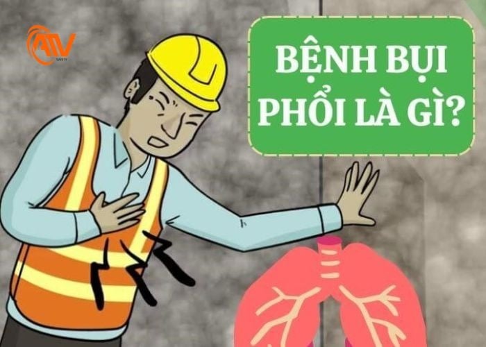 Những biến chứng nguy hiểm của bệnh bụi phổi