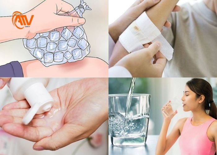 Những bước cơ bản sơ cứu khi bị bỏng dầu mỡ