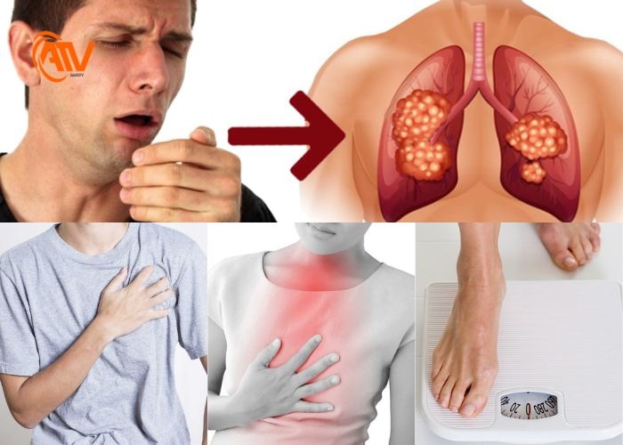 Dấu hiệu của việc khi hít phải bụi silic