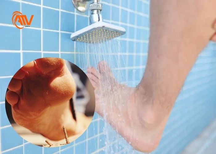 Sơ cứu khi dẫm phải đinh bước 1