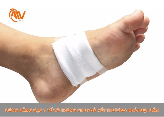 Sơ cứu khi dẫm phải đinh bước 3