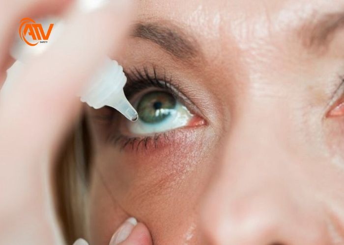 Điều trị đau mắt hàn bằng thuốc kịp thời và đúng cách