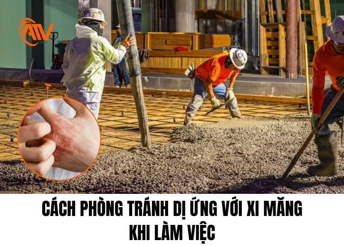 Cách phòng tránh dị ứng xi măng hiệu quả