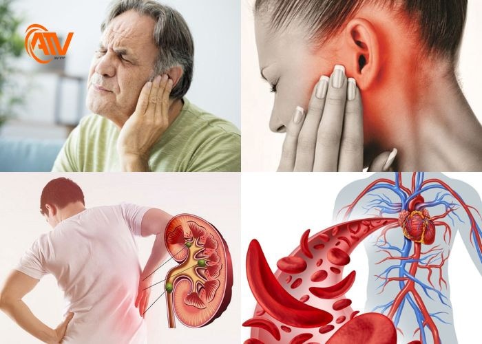 Nguyên nhân gây ra điếc một bên tai phổ biến