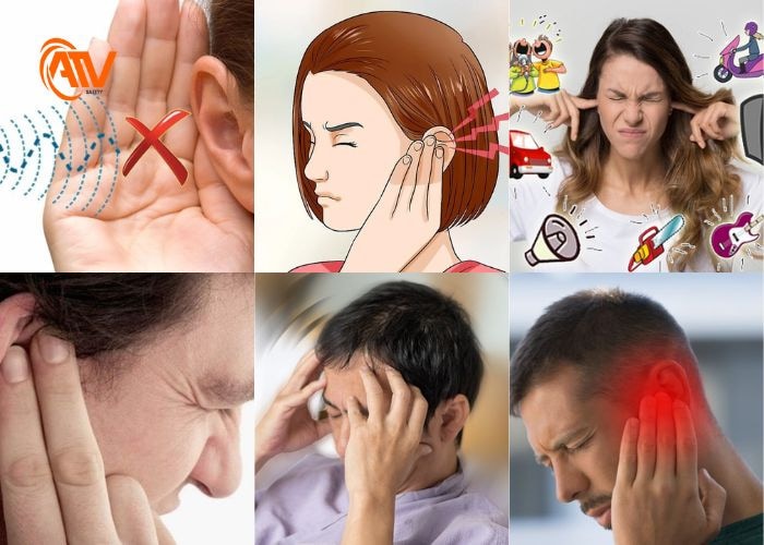Điếc một bên tai và các dấu hiệu thường gặp