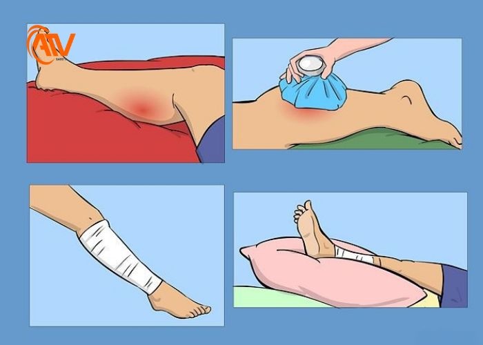 Kỹ năng sơ cứu vết thương kín