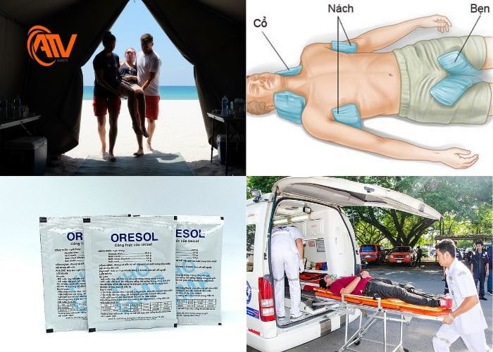 Sơ cứu bị say nắng