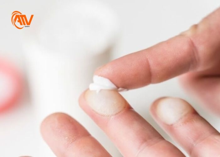 Cách sơ cứu bỏng nông