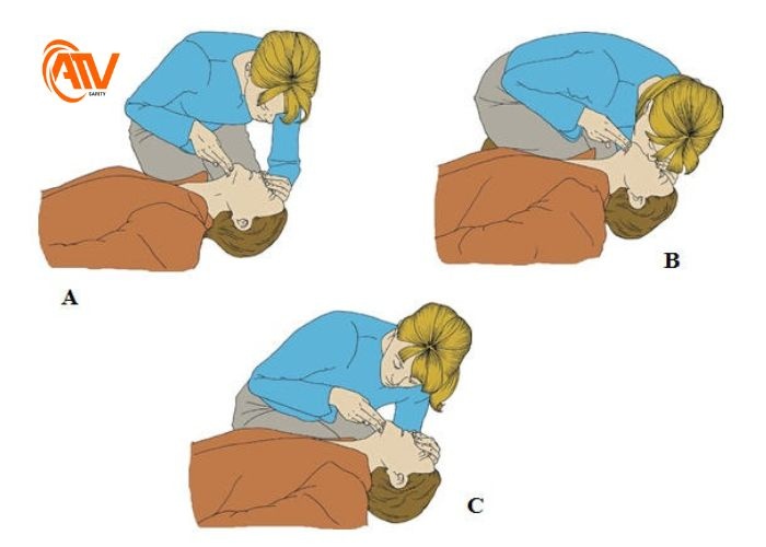 Hô hấp nhân tạo khi nạn nhân không thở
