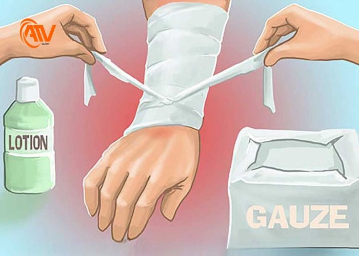 Bước cuối sơ cứu người bị điện giật