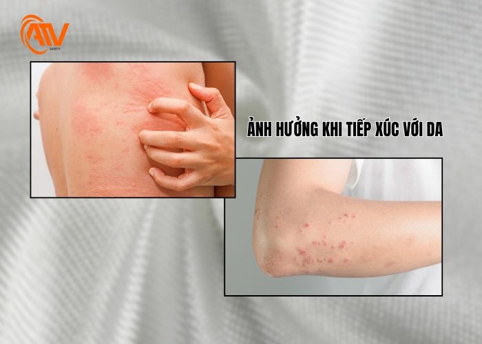 Ảnh hưởng của sợi thủy tinh khi tiếp xúc với da