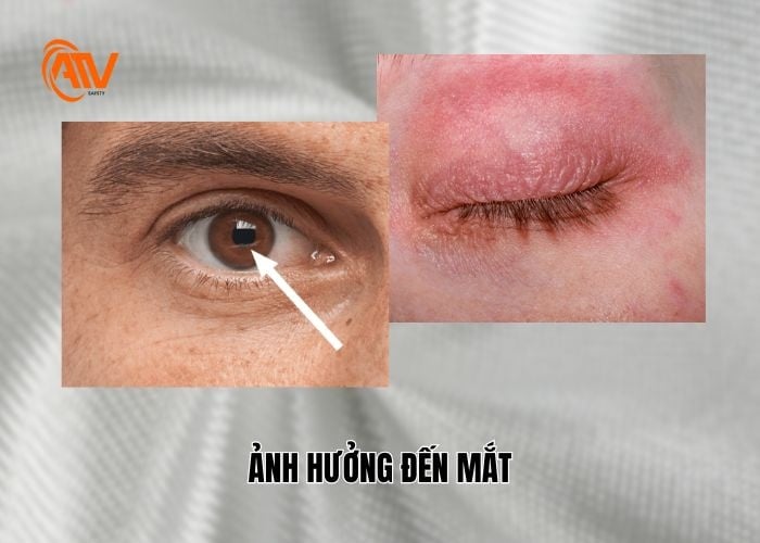 Ảnh hưởng đến mắt khi tiếp xúc với sợi thủy tinh