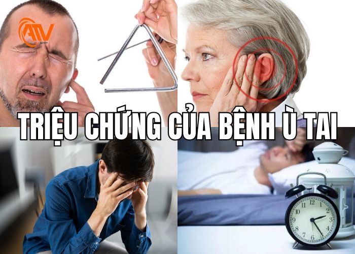 Triệu chứng phổ biến khi mắc phải bệnh ù tai