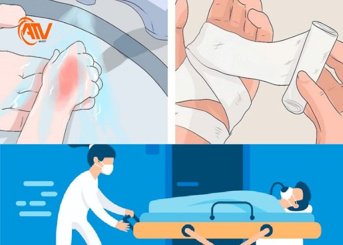 Các bước xử lý khi bị bỏng axit an toàn