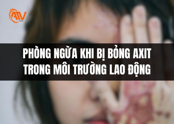 Phòng ngừa bỏng axit trong môi trường lao động lâu dài
