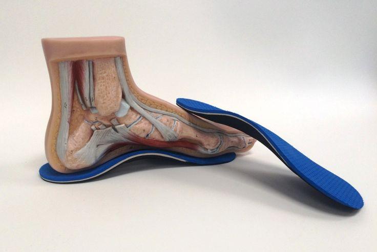 lót giày chỉnh hình thể thao