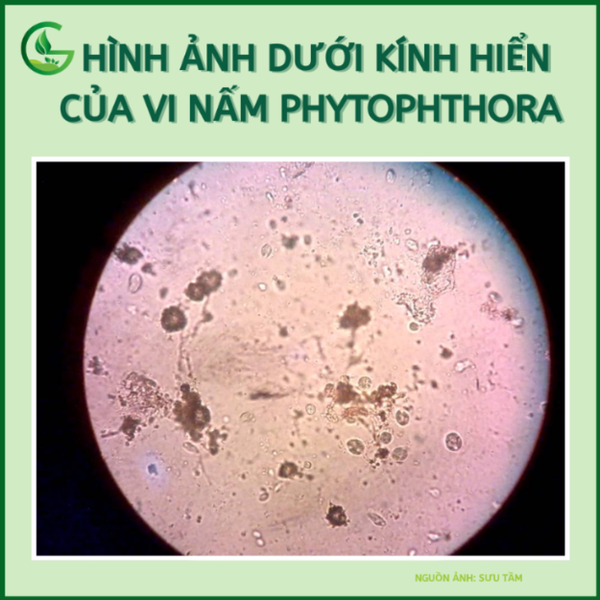 hình ảnh dưới kính hiển của vi nấm Phytophthora