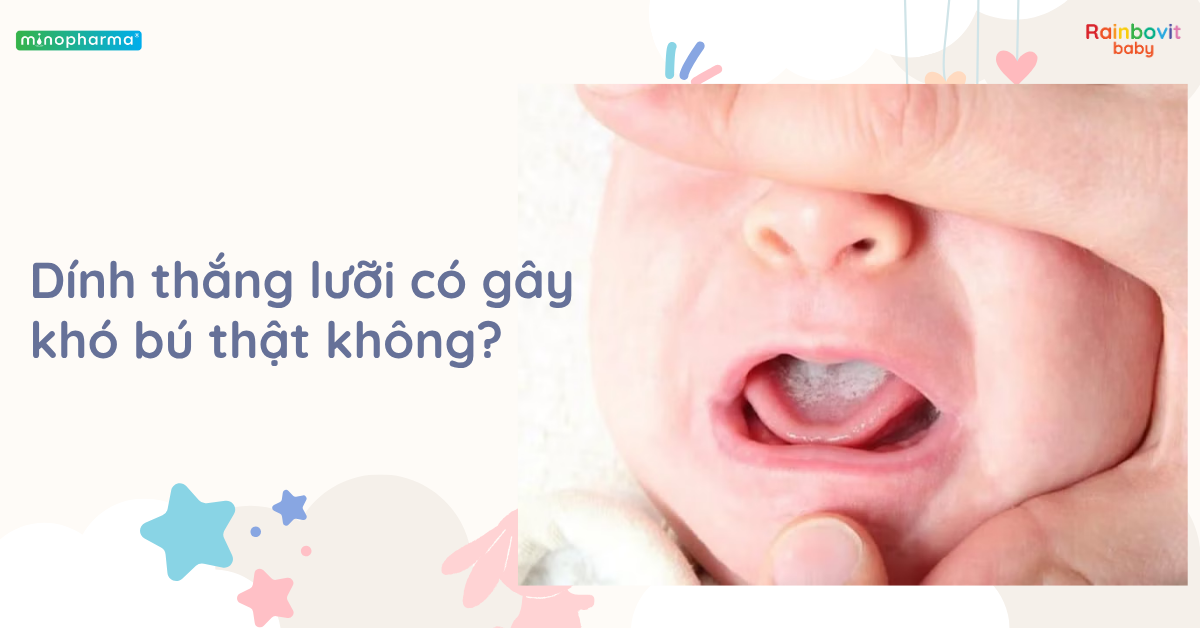 Dính thắng lưỡi ở trẻ (Ankyloglossia): Khi nào cần cắt?