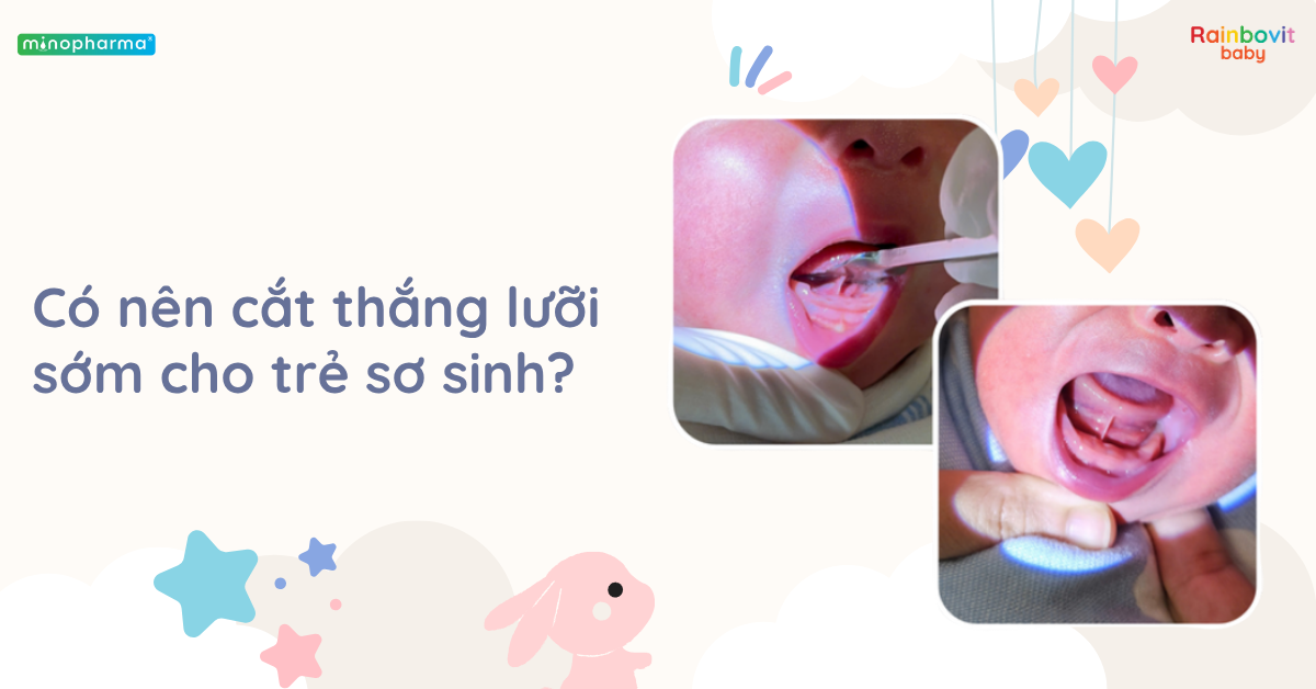 Dính thắng lưỡi ở trẻ (Ankyloglossia): Khi nào cần cắt?