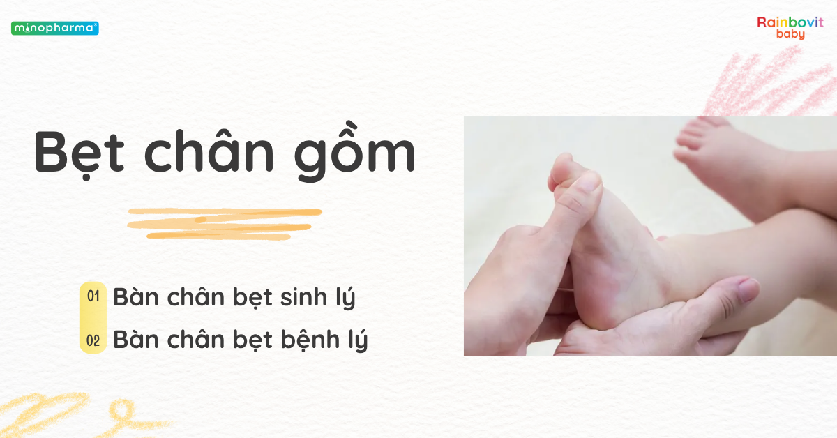 Hội chứng bàn chân bẹt ở trẻ: Bình thường hay bệnh lý?