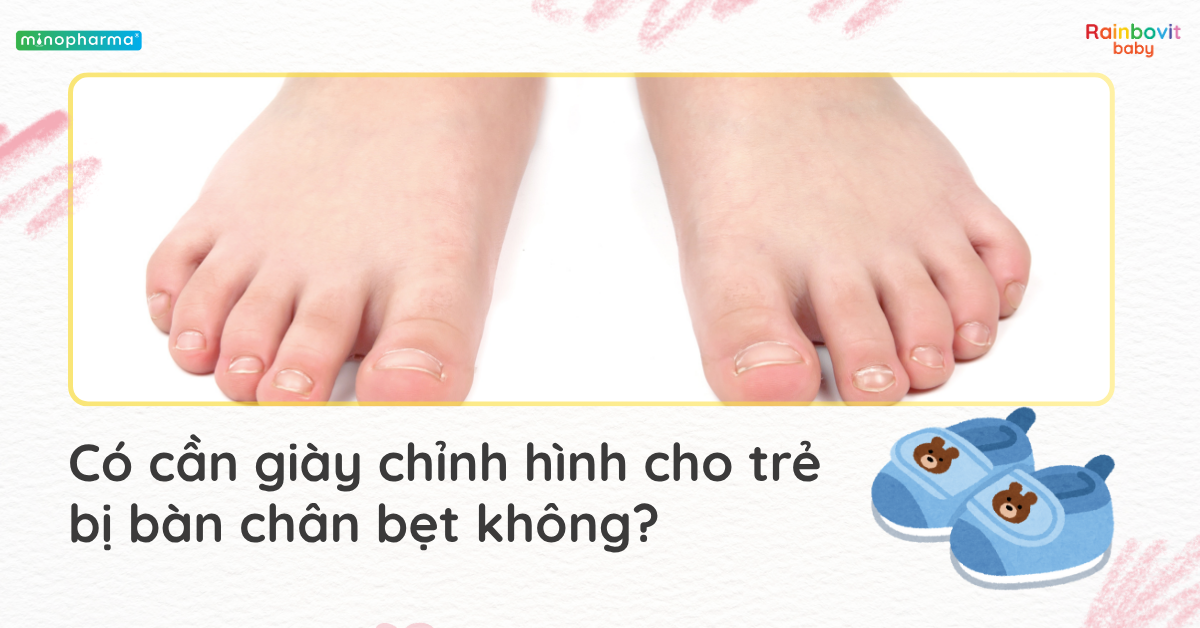 Hội chứng bàn chân bẹt ở trẻ: Bình thường hay bệnh lý?