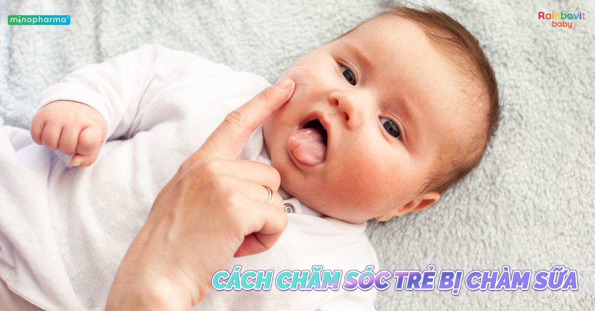 Chàm sữa ở trẻ nhỏ: Nguyên nhân, cách chăm sóc và phòng ngừa tái phát