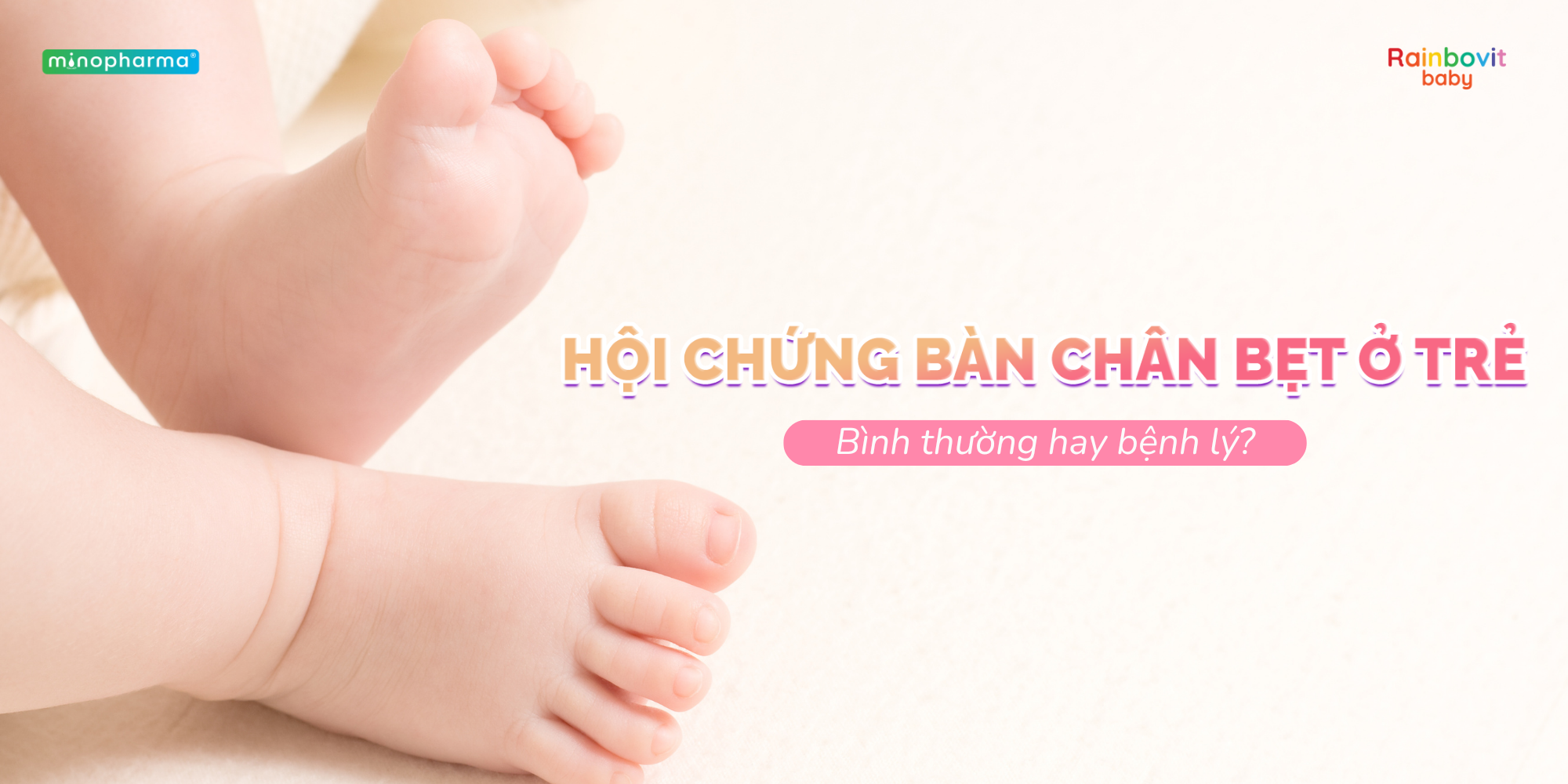 Hội chứng bàn chân bẹt ở trẻ: Bình thường hay bệnh lý?