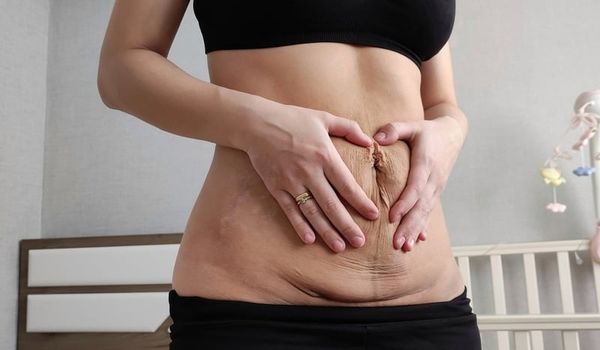 Thời Điểm Vàng Để Bắt Đầu Giảm Cân Sau Sinh