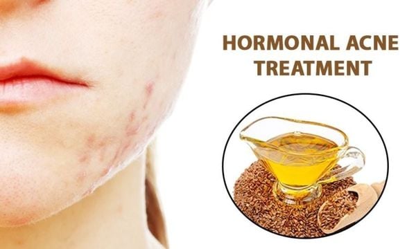 Có không ít chị em phụ nữ sử dụng dầu hạt lanh như một giải pháp làm đẹp da từ sâu bên trong