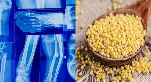 Hạt kê hỗ trợ tăng cường sức khỏe xương răng