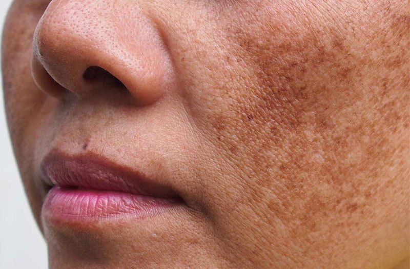 Viên uống chống nắng chứa những hoạt chất gì?