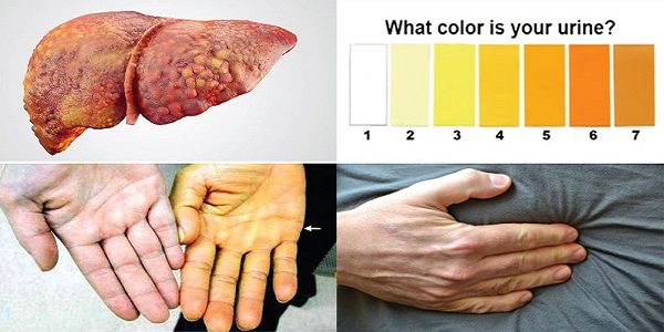 Những tác dụng phụ có thể gặp (và cách xử lý)