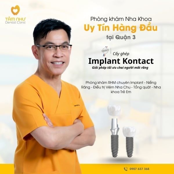 Trụ Implant Kontact – Dòng Implant cao cấp sản xuất 100% từ Pháp