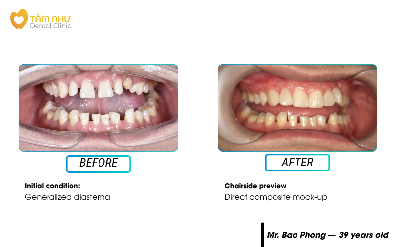 Cosmetic dentistry
