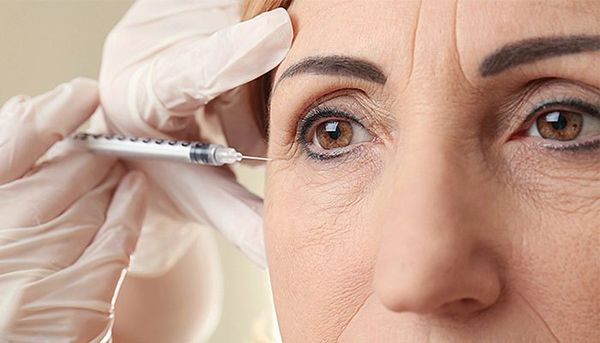 XÓA NHĂN VÙNG MẶT