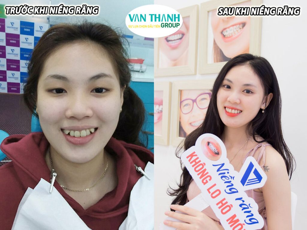 Thăng hạng nhan sắc cùng Trung Tâm Chỉnh Nha Vạn Thành.