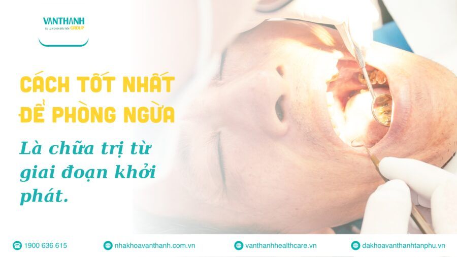 Lợi ích khi chăm sóc, điều trị bệnh lý về răng đúng thời điểm