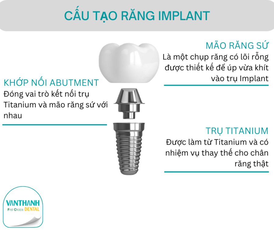 TRỒNG RĂNG IMPLANT CÓ GÂY DỊ ỨNG KHÔNG?