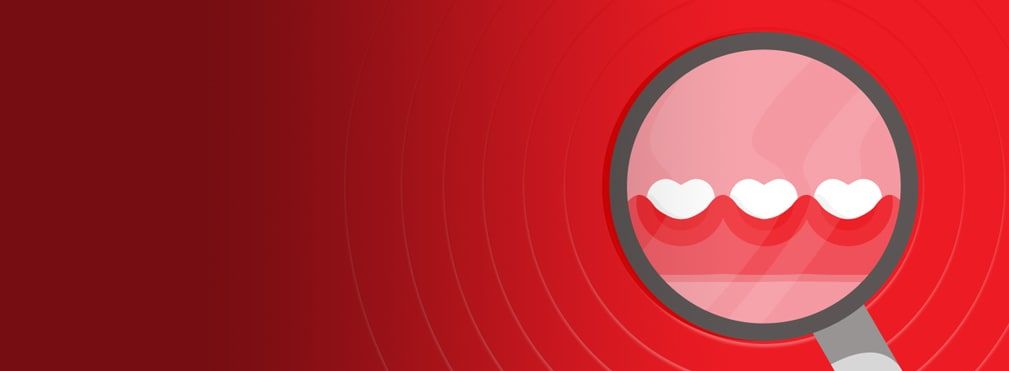 Viêm nha chu, phòng ngừa tốt hơn điều trị!