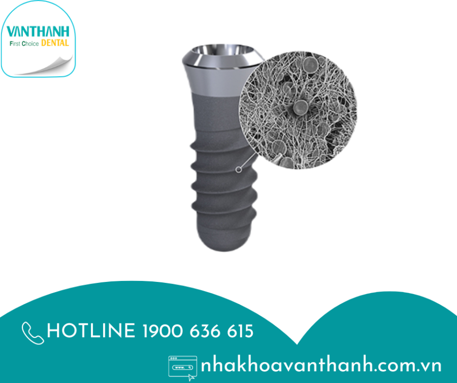 TRỒNG RĂNG IMPLANT KHI ĐI MÁY BAY CÓ BỊ CẢNH BÁO AN NINH?