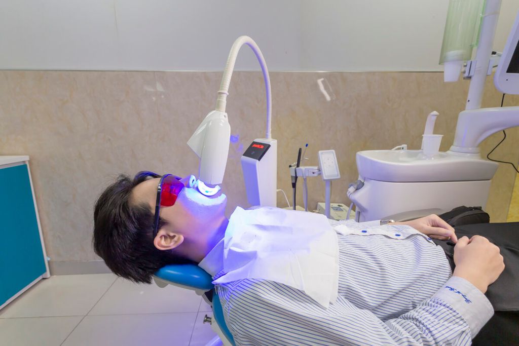 4 thắc mắc thường gặp khi quyết định tẩy trắng răng