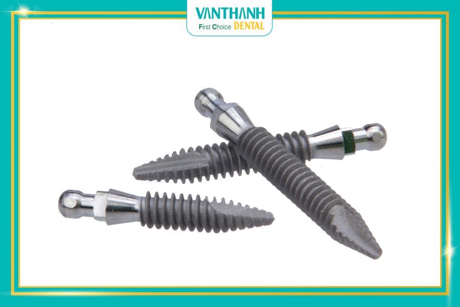 Mini Implant và những điều cần biết!
