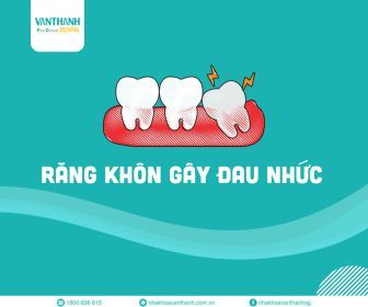 8 Điều cần làm sau khi nhổ răng khôn