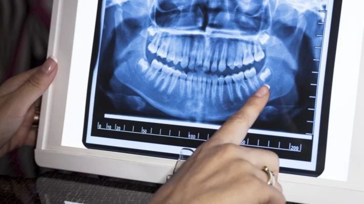 Chụp phim toàn hàm Panorama – Chẩn đoán chính xác, điều trị hiệu quả tại Nha khoa Vạn Thành