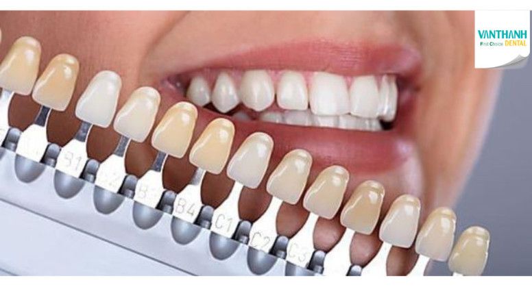 CƠ CHẾ HOẠT ĐỘNG CỦA TẨY TRẮNG RĂNG NHƯ THẾ NÀO?