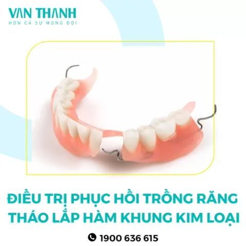 Điều trị 19