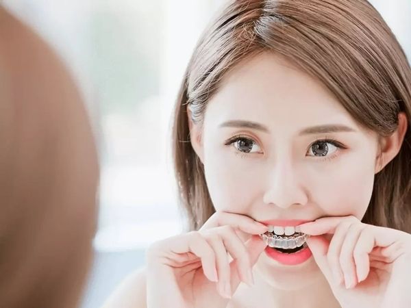 quy trình niềng răng mắc cài kim loại