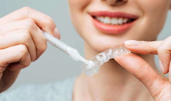 cách tẩy trăng răng tại nhà